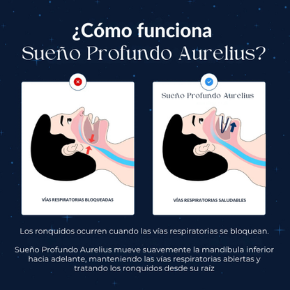 Sueño Profundo Aurelius™ - dipositivo anti-ronquidos